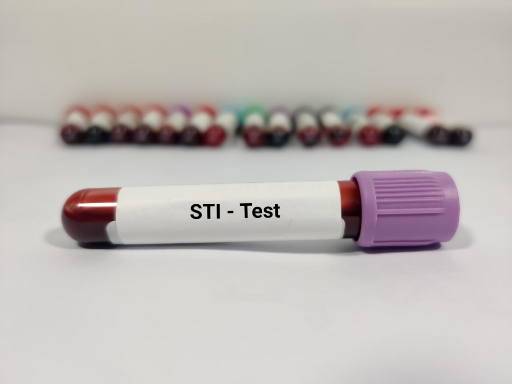 STI/STD Testing & Treatment